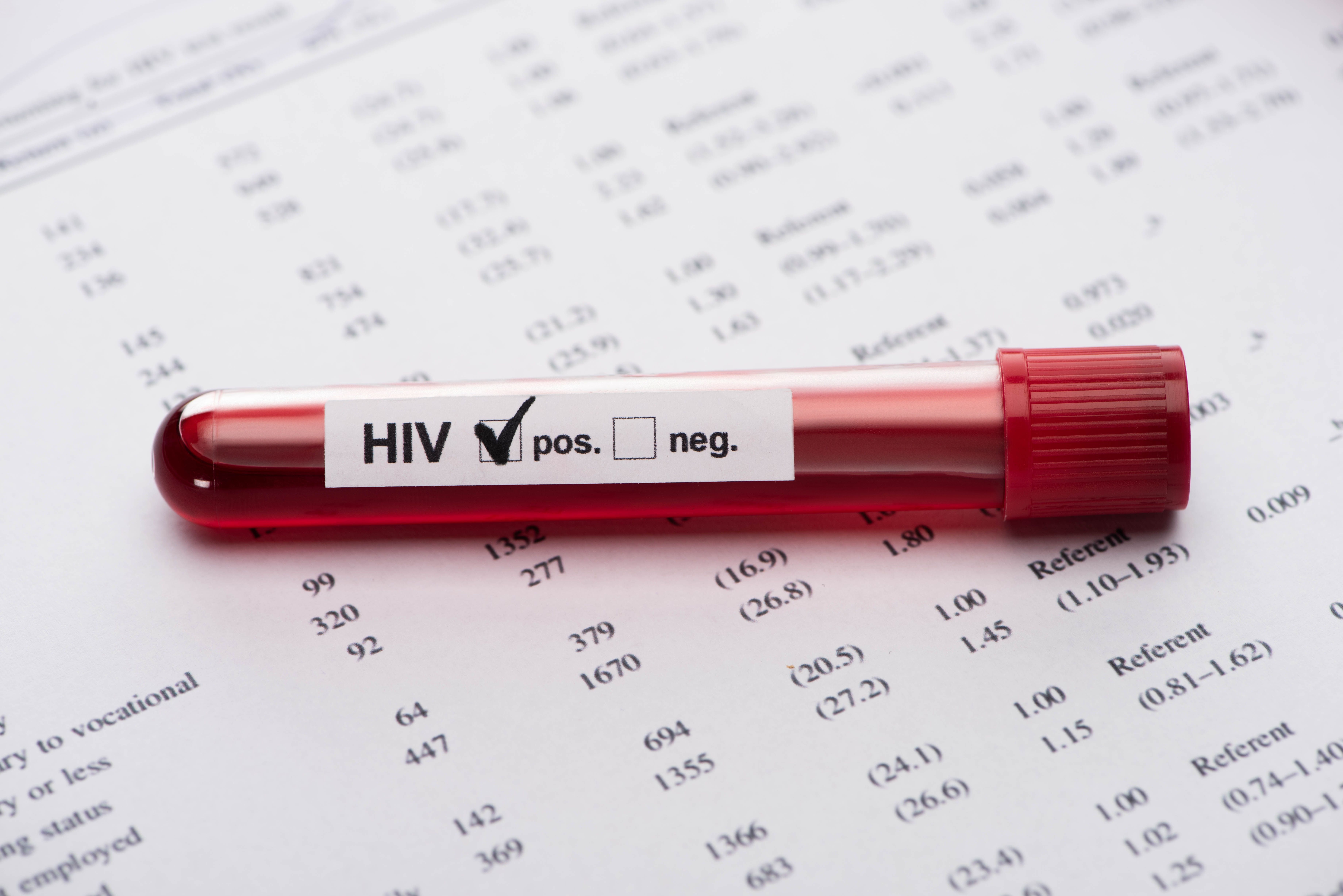 Test positif au VIH 